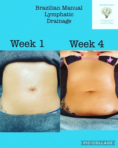 The Serenity Spot - Treatment Setup